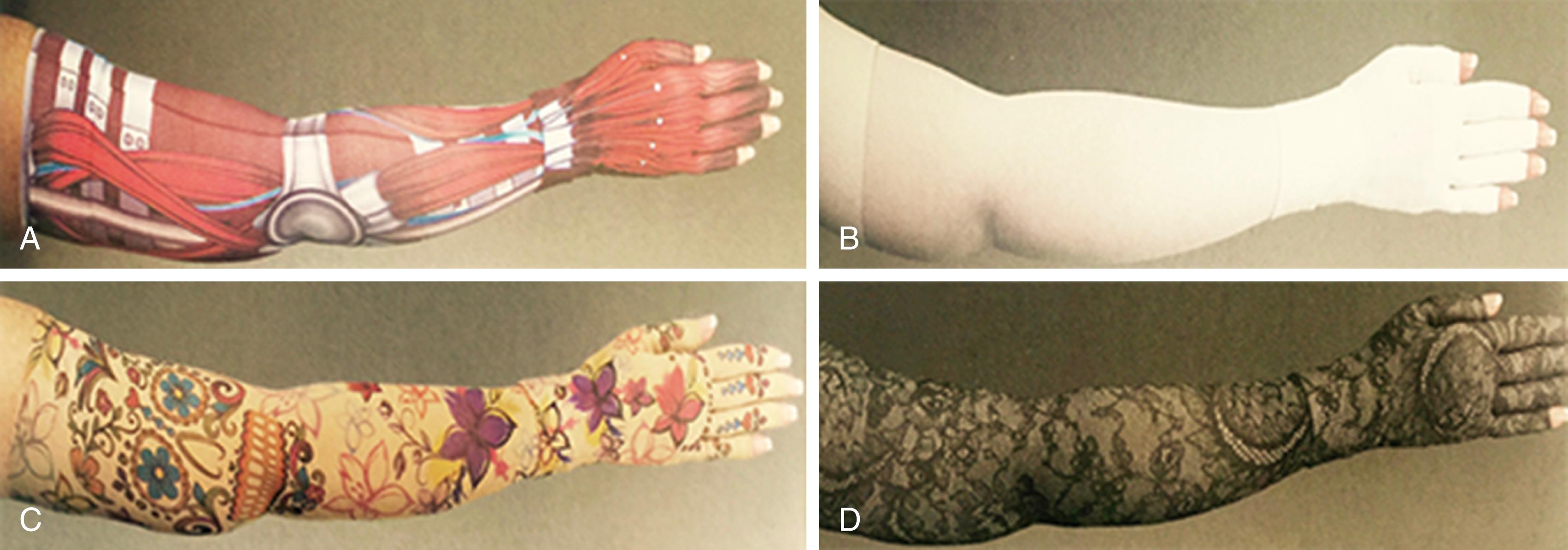 Figure 168.10, Compression Garments Materials.