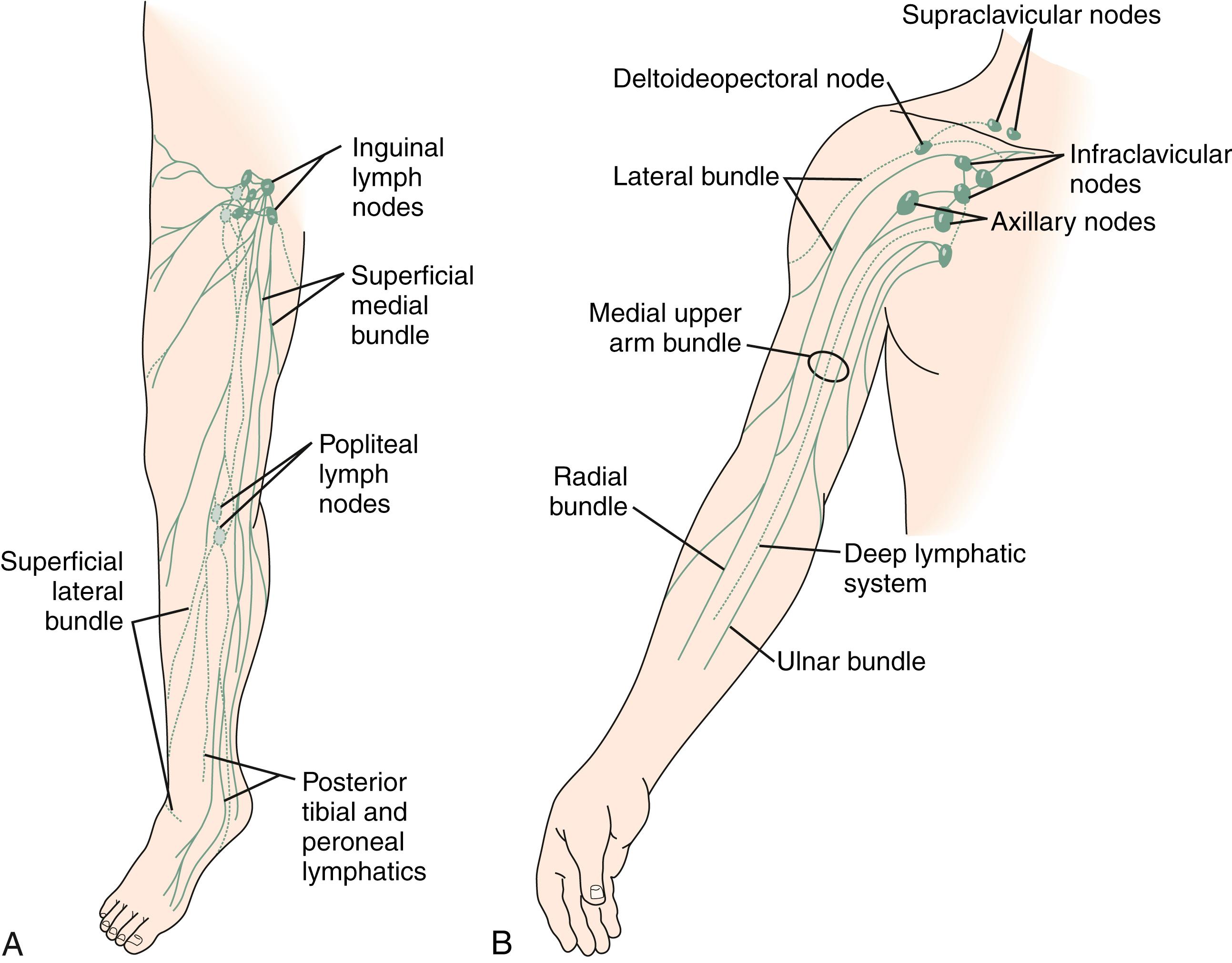 Figure 169.1, ( A ) Superficial lymphatic system of the lower extremity. ( B ) Lymphatic system of the upper extremity.