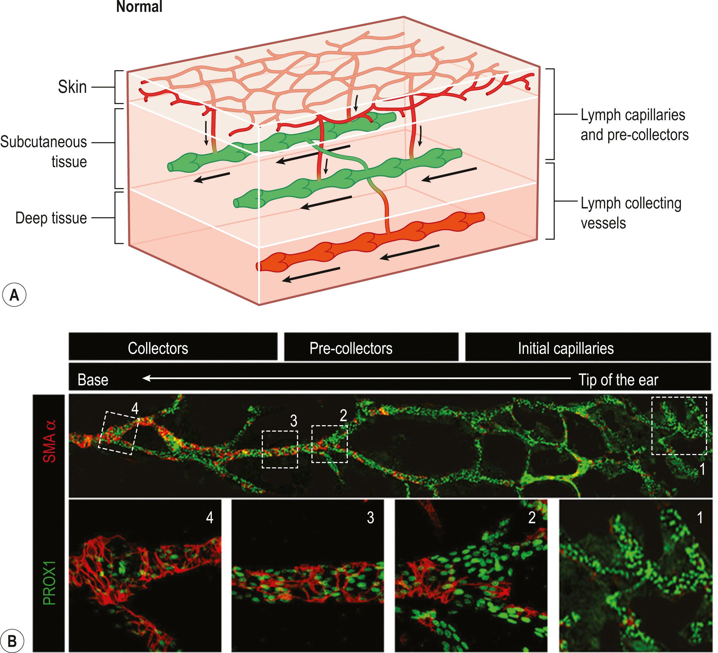 Figure 28.2, Microscopic anatomy of the lymphatic system. (A) Schematic of superficial and deep lymphatics of the skin. (B) Fluorescent immune-histological depiction of mouse ear skin lymphatic tree. Mouse ear skin whole mount stained for Prox1 (pan LEC marker) and Smooth muscle actin alpha to identify the capillary, pre-collecting and collecting lymphatic vessels in a single plane (upper panel). High magnification images 1, 2, 3, and 4 from the upper panel image showing spatial separation of capillaries at the ear tips to collectors at ear base. Note the collecting lymphatic vessels being tightly wrapped by SMA cells enabling them to pump the lymph.