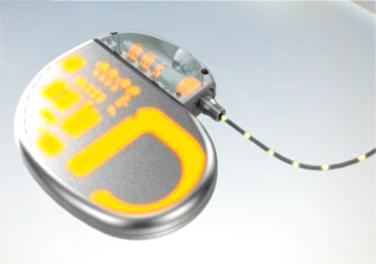 Figure 24.3, Induced voltages or high-frequency energy can damage unprotected circuitry.