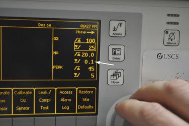Fig. 25.5, Setting machine alarm limits. Alarm limit values are easy to adjust, although this task could be time-consuming during routine pre-use checkout. Safe default values can be established locally and set by trained technicians, which will help keep limits consistent. Note the inappropriately low minute ventilation threshold default on this machine (arrow) .