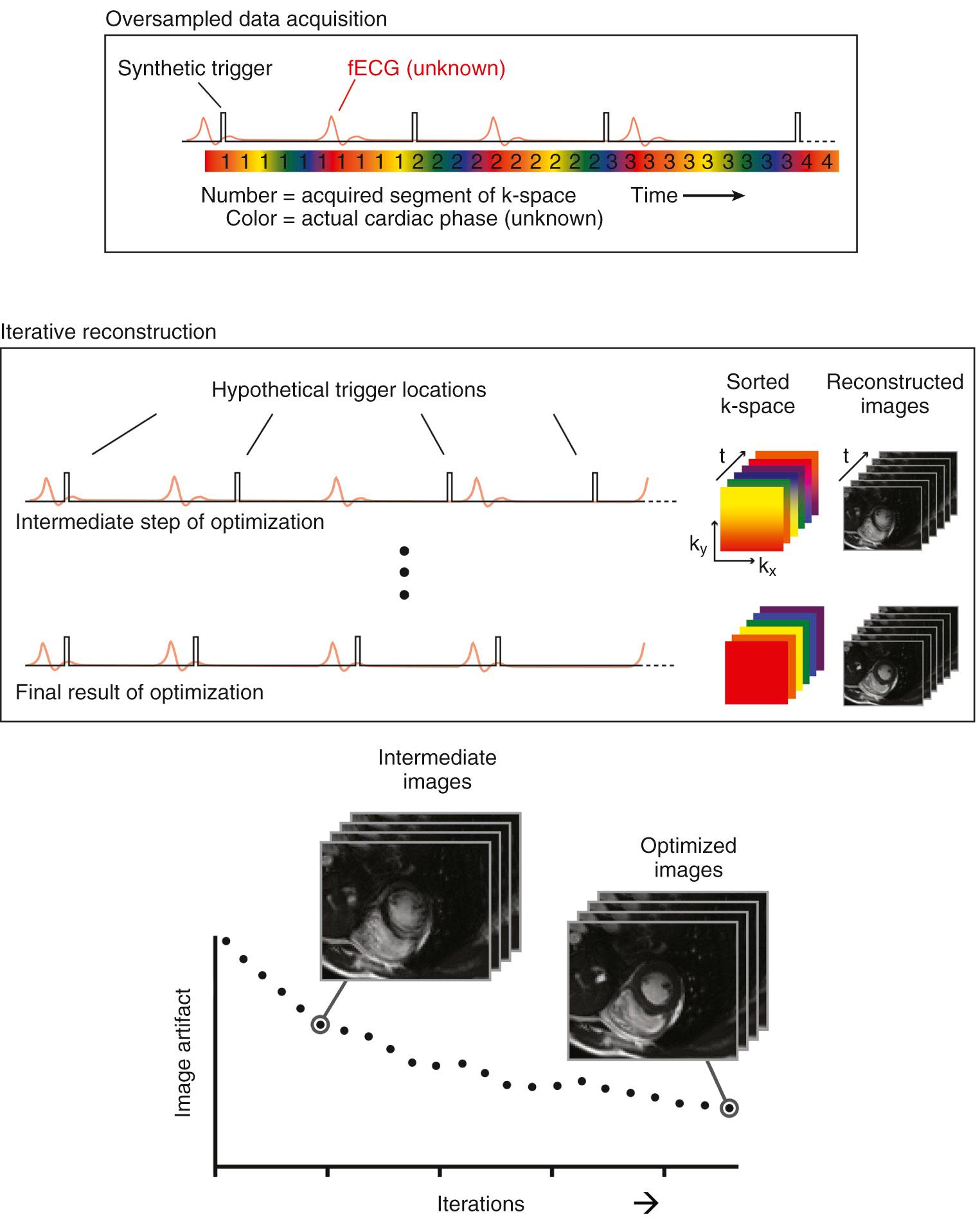 Fig. 7.1, Metric optimized gating. The colors represent the cardiac phases and the numbers represent the lines of data comprising the magnetic resonance image. An artificial trigger is used to collect gated imaging data. Initially there is a misgating artifact, represented by the blurring of colors in the final images. After iterative reconstruction where superfluous imaging data are discarded, the reconstruction matches the R-R interval that was present during the acquisition, represented by the uniform colors in the final images. The correct reconstruction was identified through the lack of artifact in the resulting images.