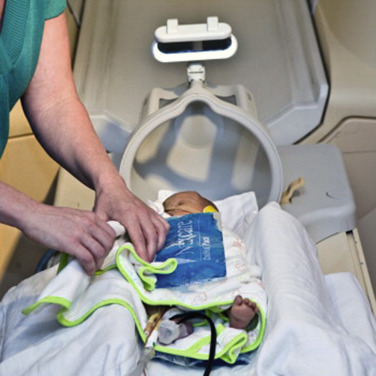 FIG 6-2, Preparation of an infant for MRI. The infant is swaddled with blankets and covered with warm hot packs to encourage sleep. The ears are protected with neonatal earmuffs, and an MR-compatible pulse oximeter with fiberoptic probe is attached to the infant's right foot to monitor the vital parameters.