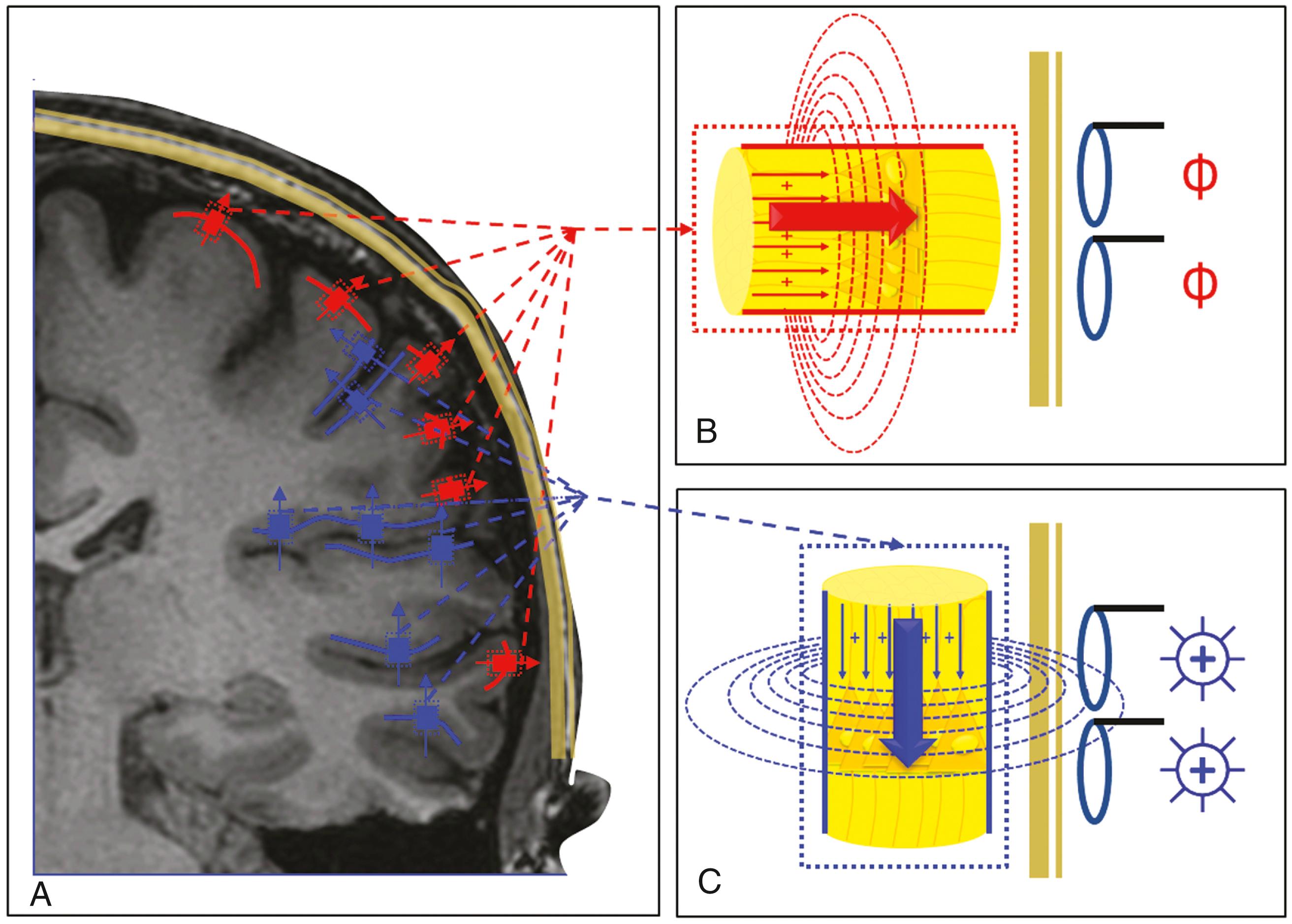 Figure 86.1, Principles of magnetic source imaging.