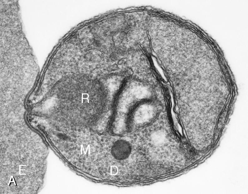 FIG. 274.4, Morphologic features of Plasmodium parasites.