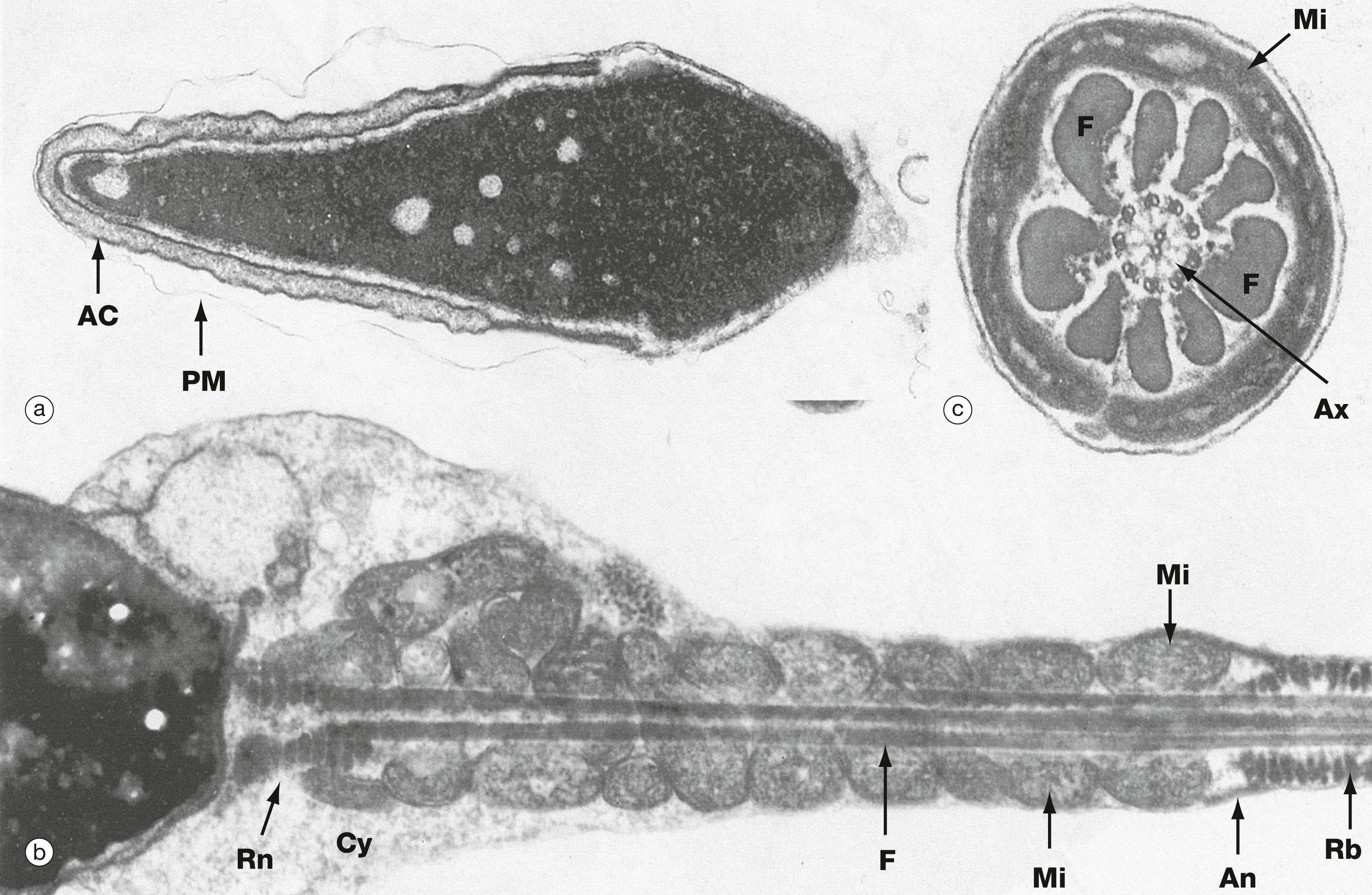 Fig. 18.7, Spermatozoa