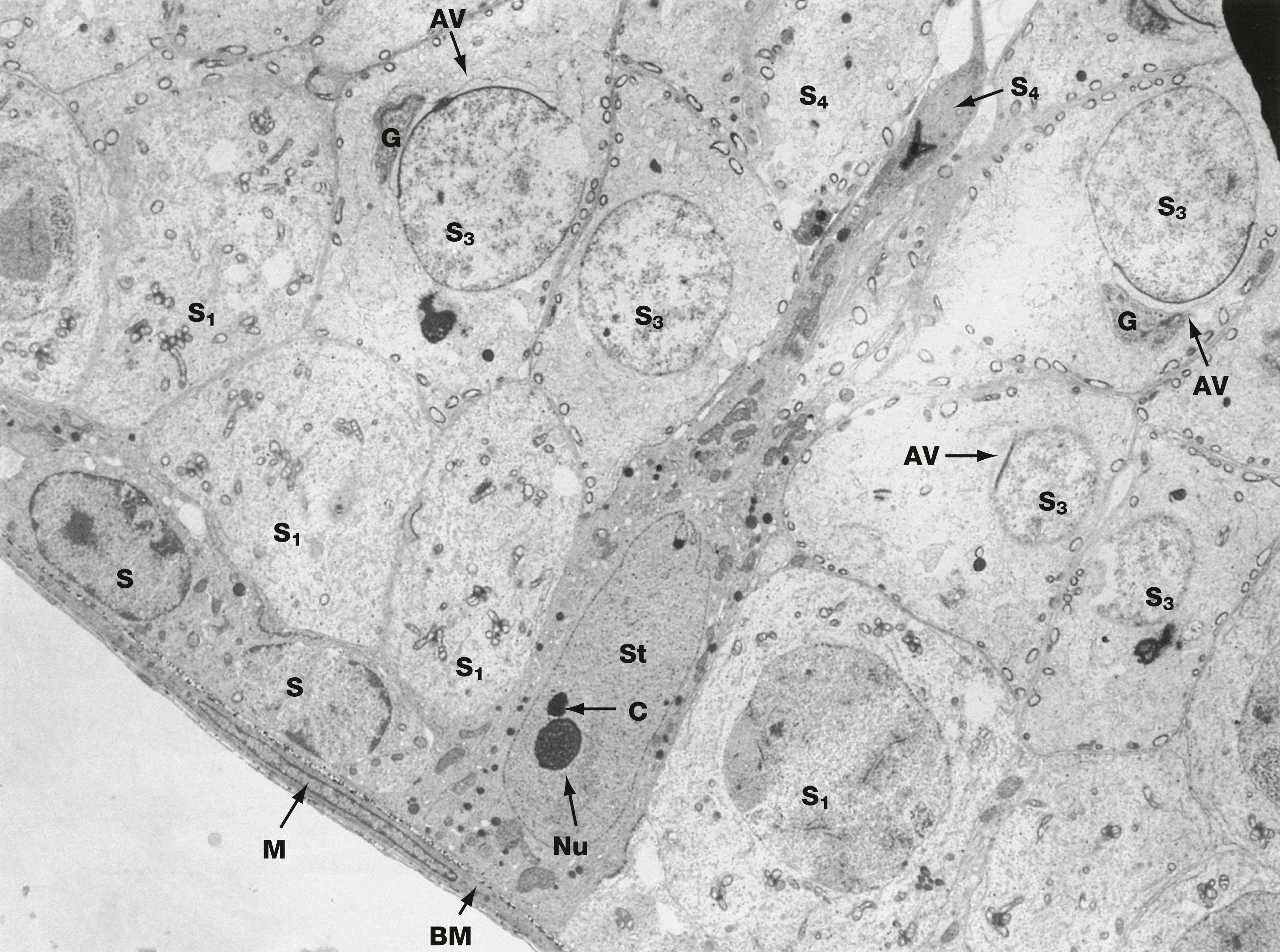 Fig. 18.8, Sertoli cell EM ×3400