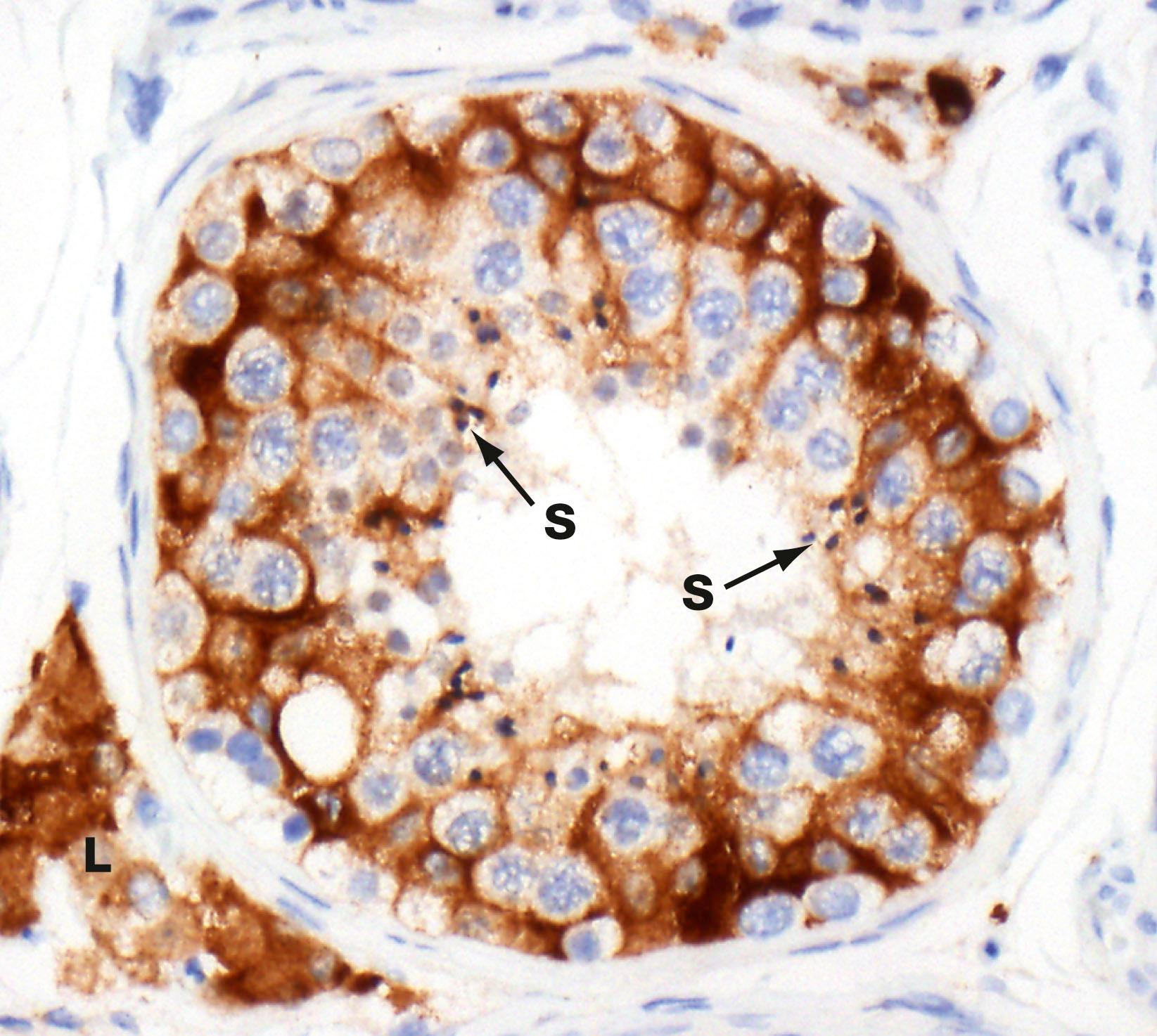 Fig. 18.9, Sertoli cells (HP)