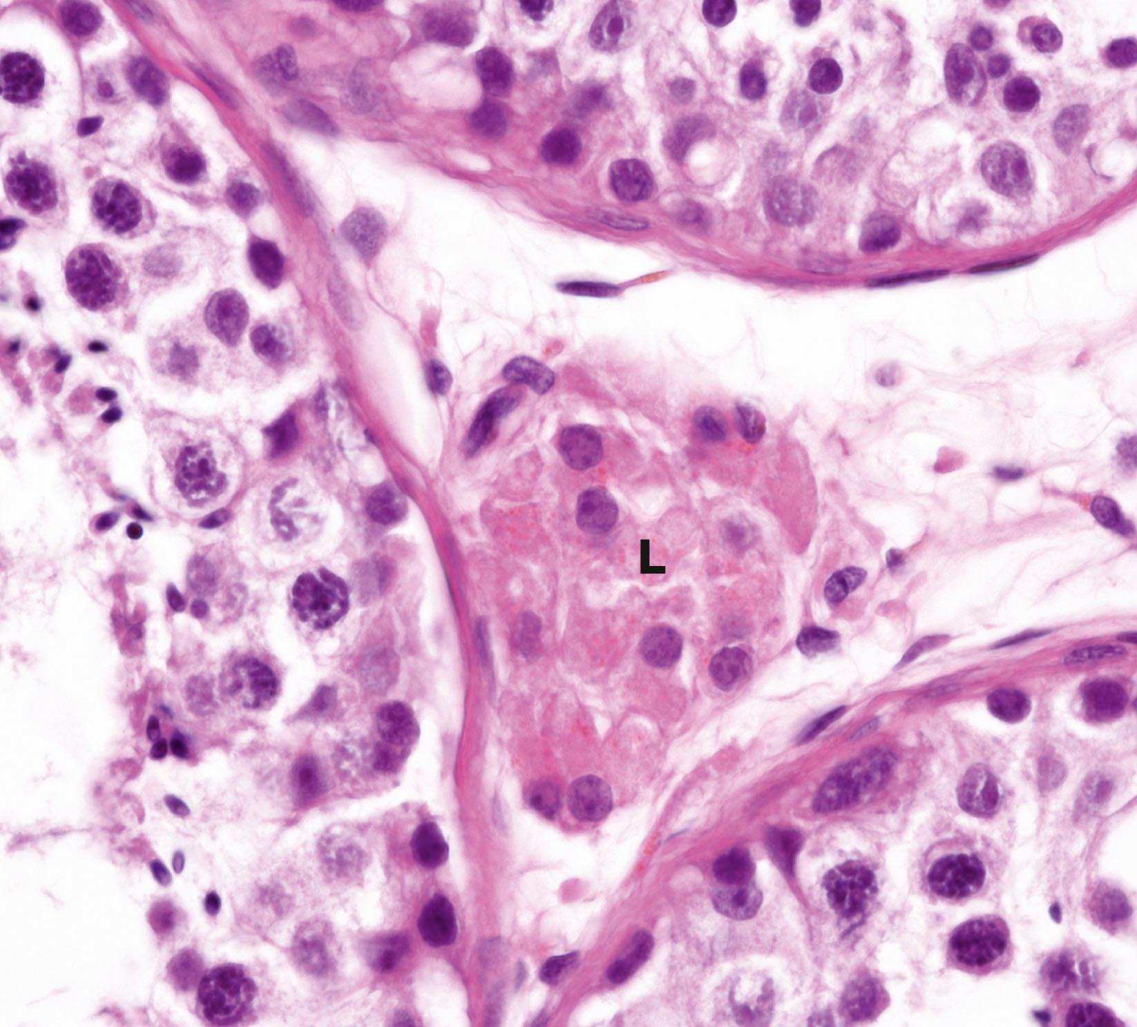 Fig. 18.10, Interstitial (Leydig) cells of the testis H&E (HP)