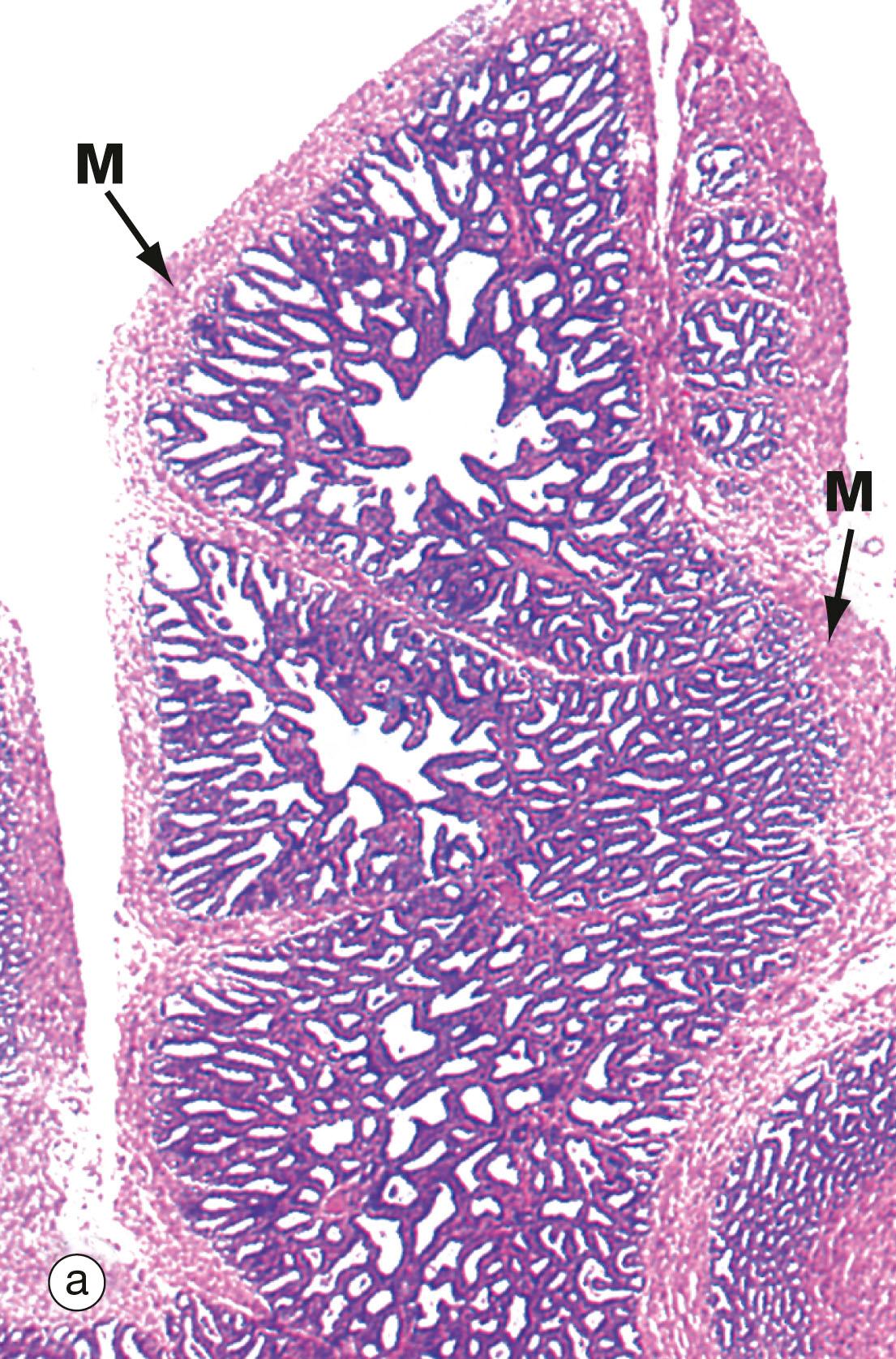 Fig. 18.16, Seminal vesicle