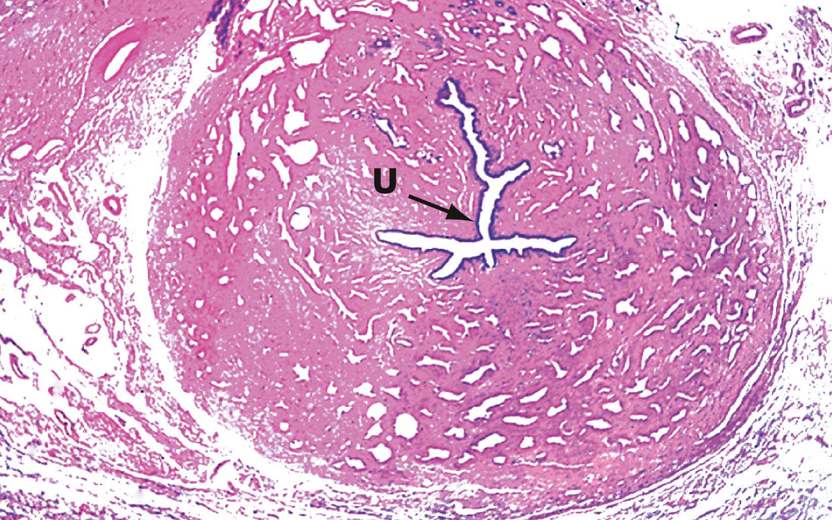 Fig. 18.21, Corpus spongiosum H&E (LP)