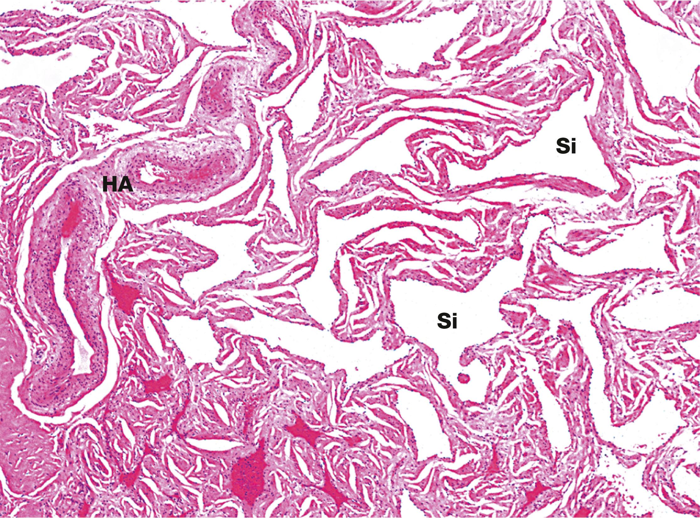 Fig. 18.22, Penile erectile tissue H&E (LP)