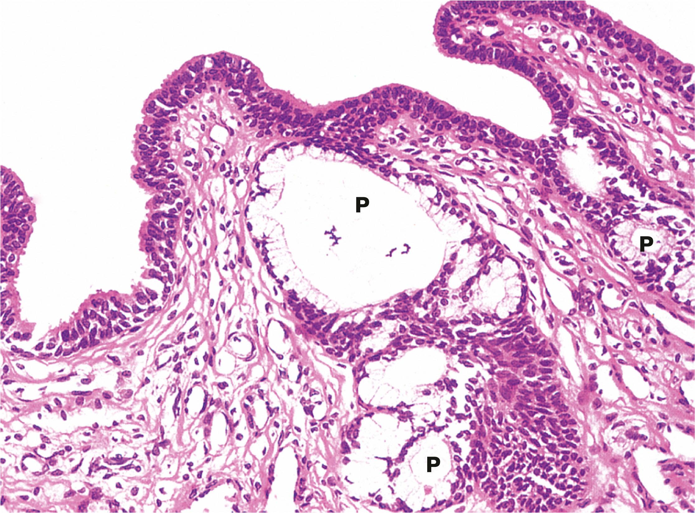 Fig. 18.23, Penile urethra H&E (HP)