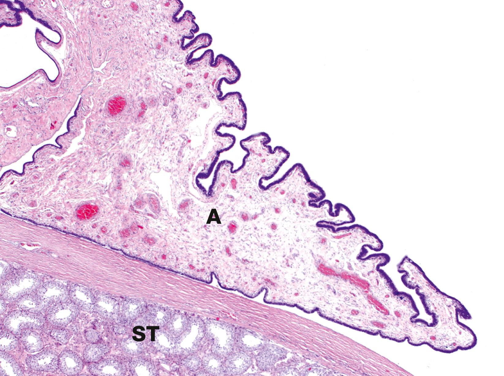 Fig. 18.12, Appendix testis H&E (LP)