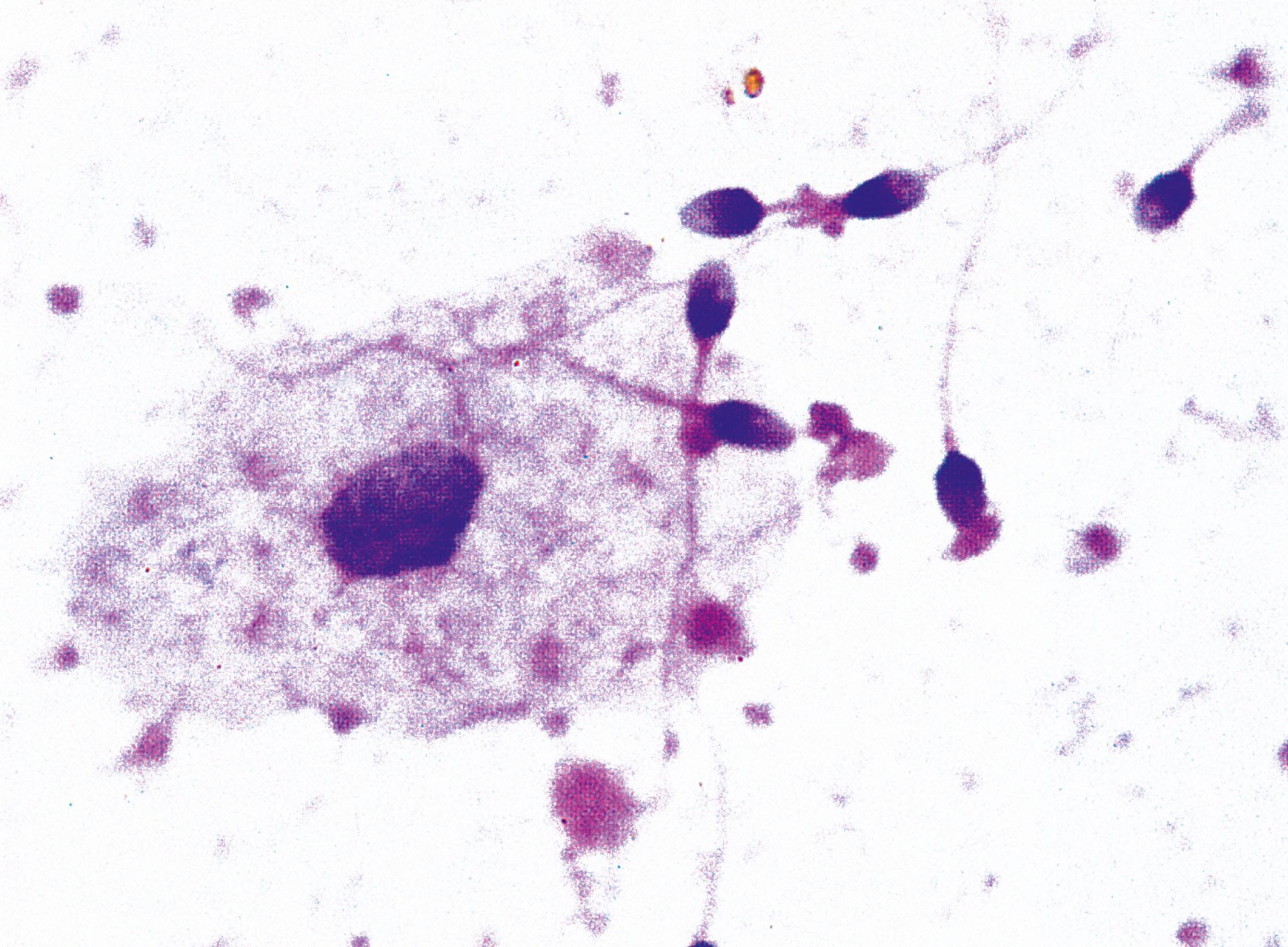 Fig. 18.24, Semen H&E (HP)