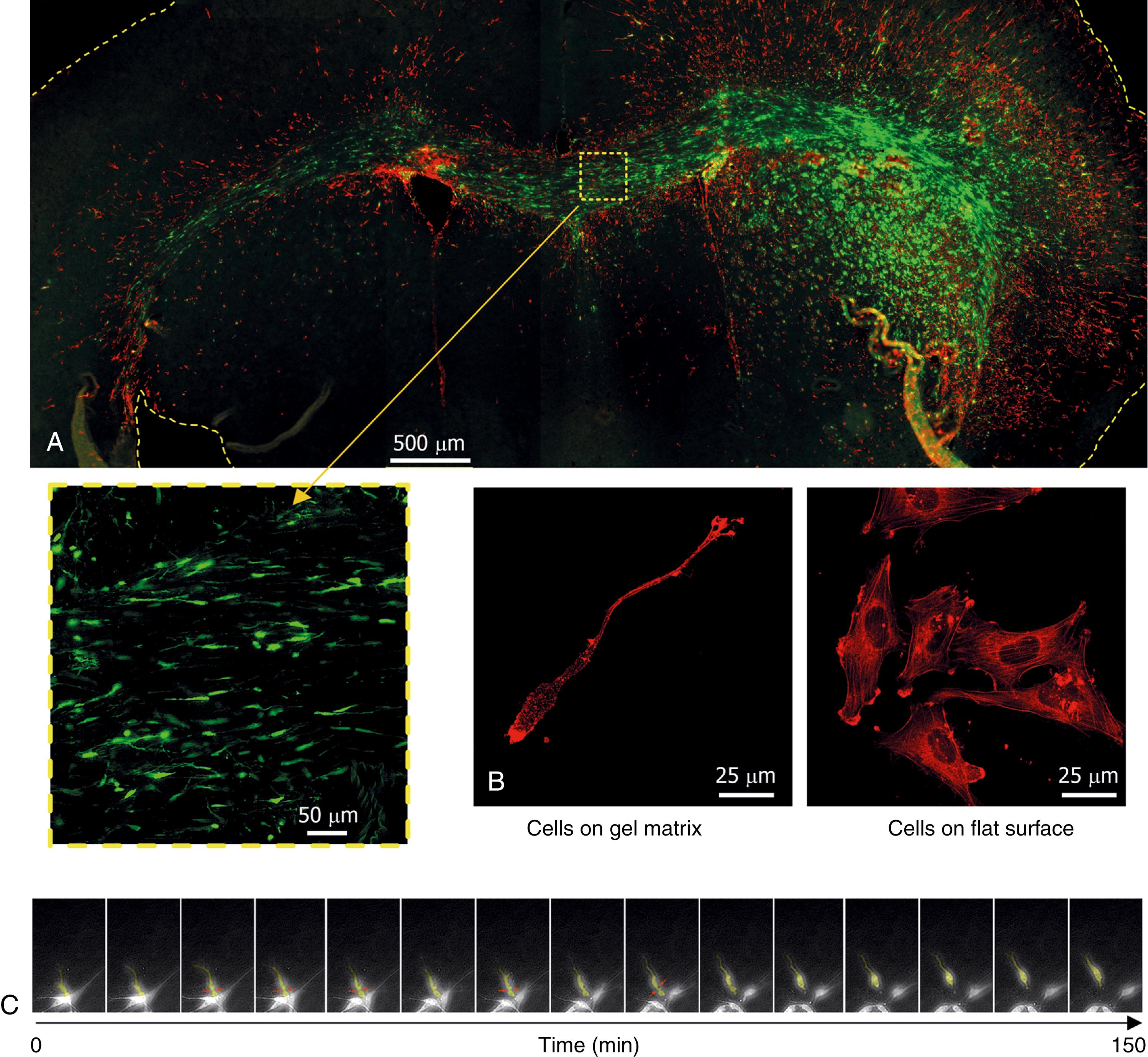 Figure 138.1, Influence of the tumor microenvironment on glioma invasion.