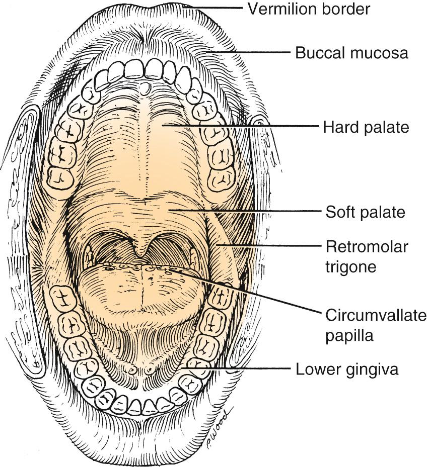 Fig. 91.1, Overview of the oral cavity demonstrates the posterior boundary at the hard palate–soft palate junction and the location of the retromolar trigone relative to the inferior alveolar ridge.