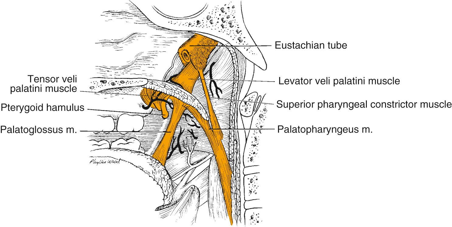 Fig. 96.3, Deep anatomy of the oropharyngeal muscles and blood vessels.