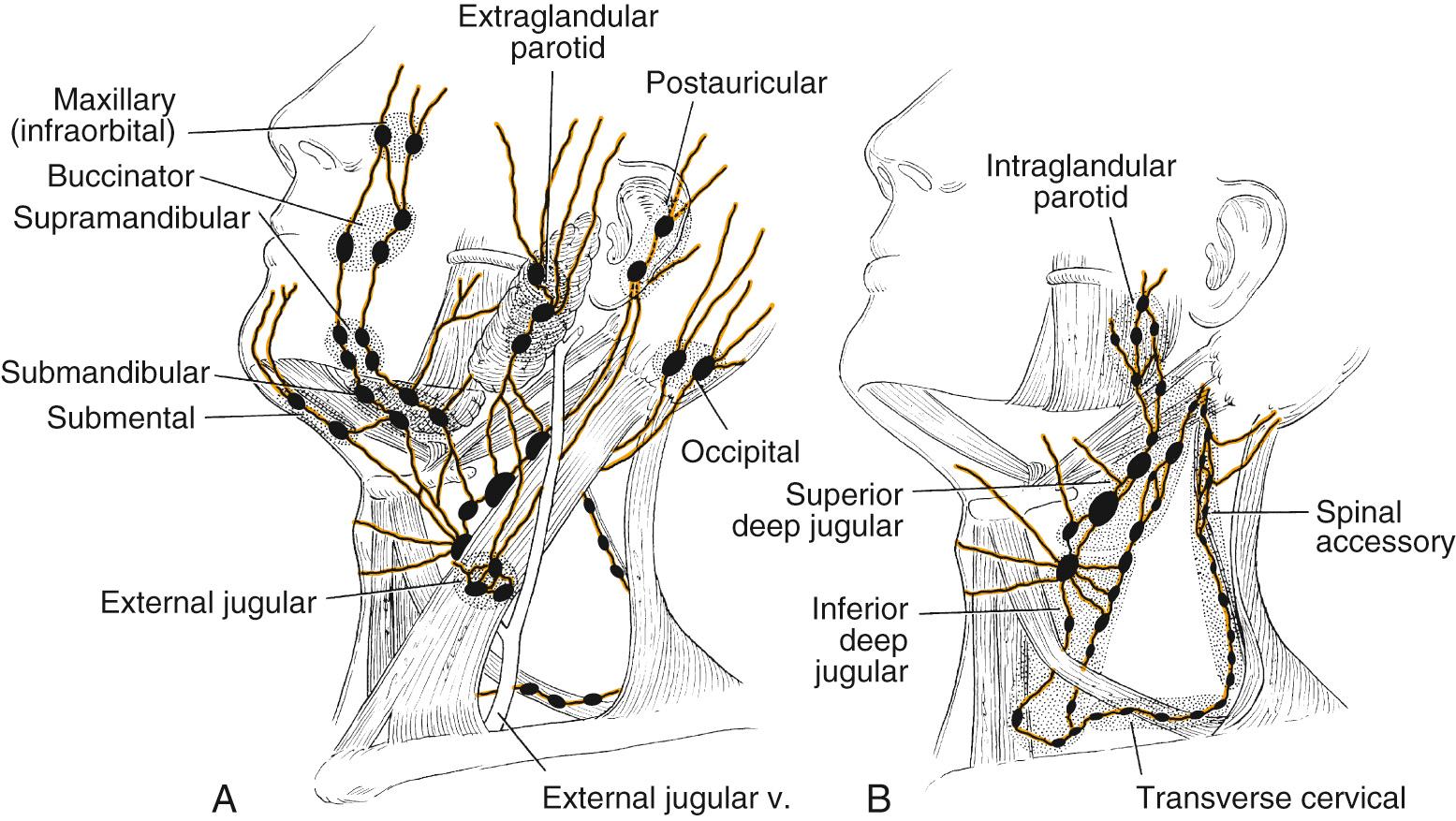 Fig. 96.4, Lymph node chains of the neck that may be involved with cervical metastatic spread from oropharyngeal tumors. (A) Superficial cervical and facial nodes. (B) Deep cervical and intraparotid lymph nodes.
