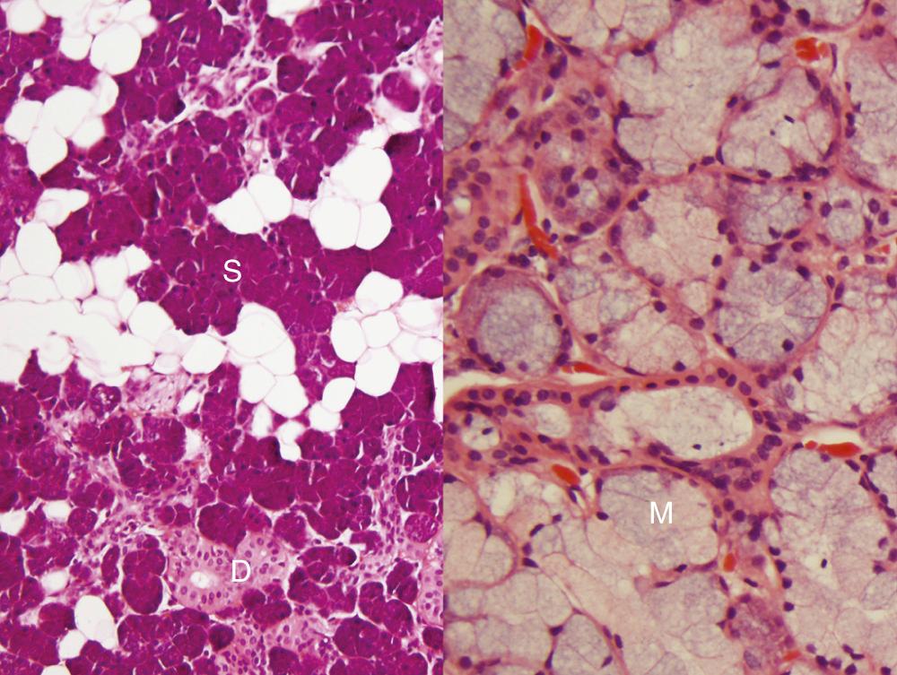 Fig. 85.2, Normal major salivary gland histology.