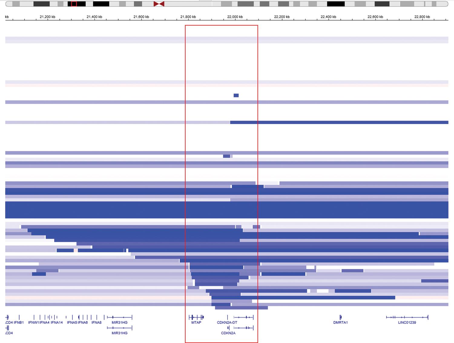 Figure 21.7, The deleted regions on chromosome 9p21 in pleural mesothelioma. Samples are arranged top to bottom and genetic content in the region is shown left to right. Dark blue represents the inferred region of homozygous (deep) deletion; light blue represents inferred regions of single copy deletion using next generation sequencing.