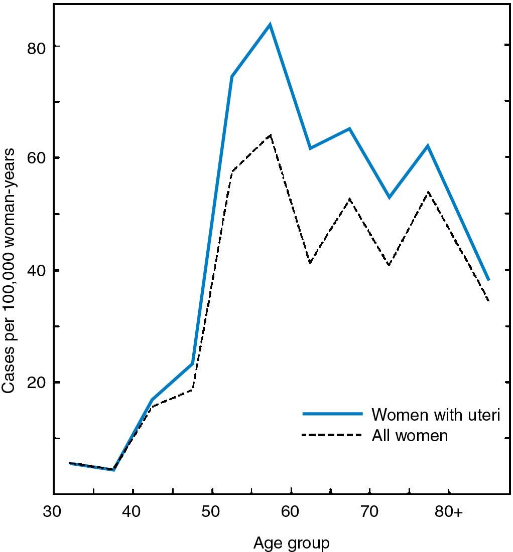 Fig. 32.1, Incidence curve for carcinoma of the endometrium by age.