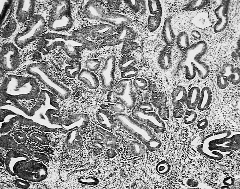 Fig. 32.2, Benign simple hyperplasia.