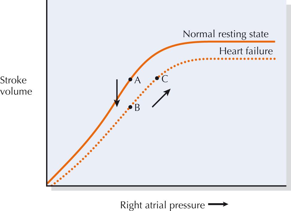 FIG 28.1, The Frank-Starling Curve Represents the Relationship Between Stroke Volume and Preload.