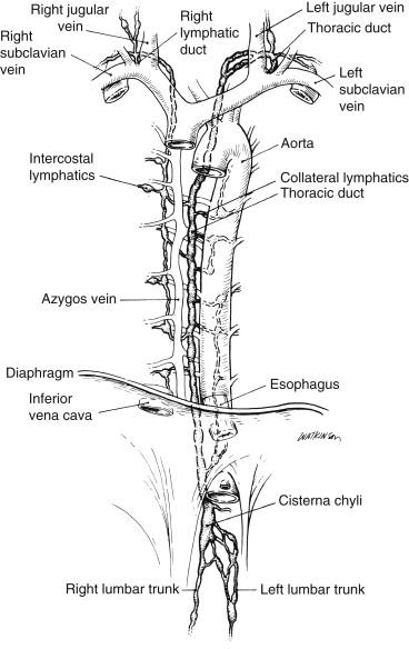 FIGURE 1, Surgical anatomy of the thoracic duct.