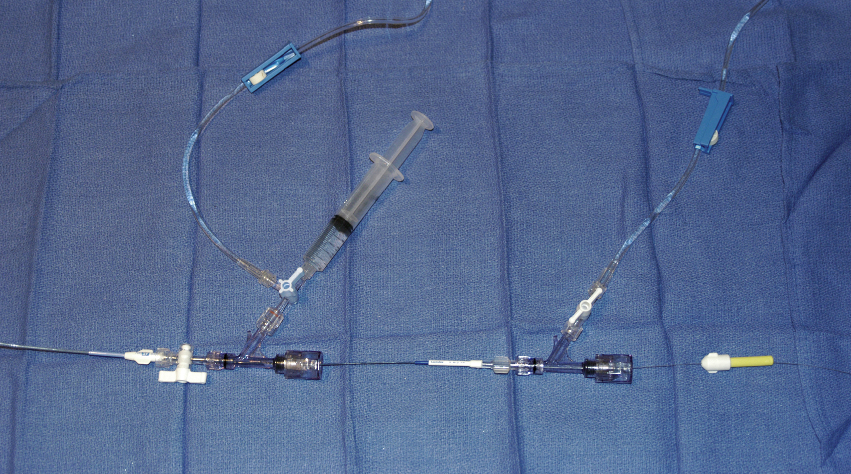 Fig. e66.1, Sample continuous flush system for neurointerventional procedures. On the left, a one-way stopcock is interposed between guide catheter and a rotating hemostatic valve (RHV) to prevent back-bleeding during microcatheter insertion. Three-way stopcock is connected to side arm of RHV for attachment of a continuous flush line and for injection of contrast material. Microcatheter is also attached to an RHV to permit continuous flushing during insertion of microwire.