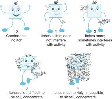 Fig. 64.3, Itch Man Scale to rate itching intensity in children, designed by Blakeney and Marvin, 2000, at Shriners Hospital for Children.