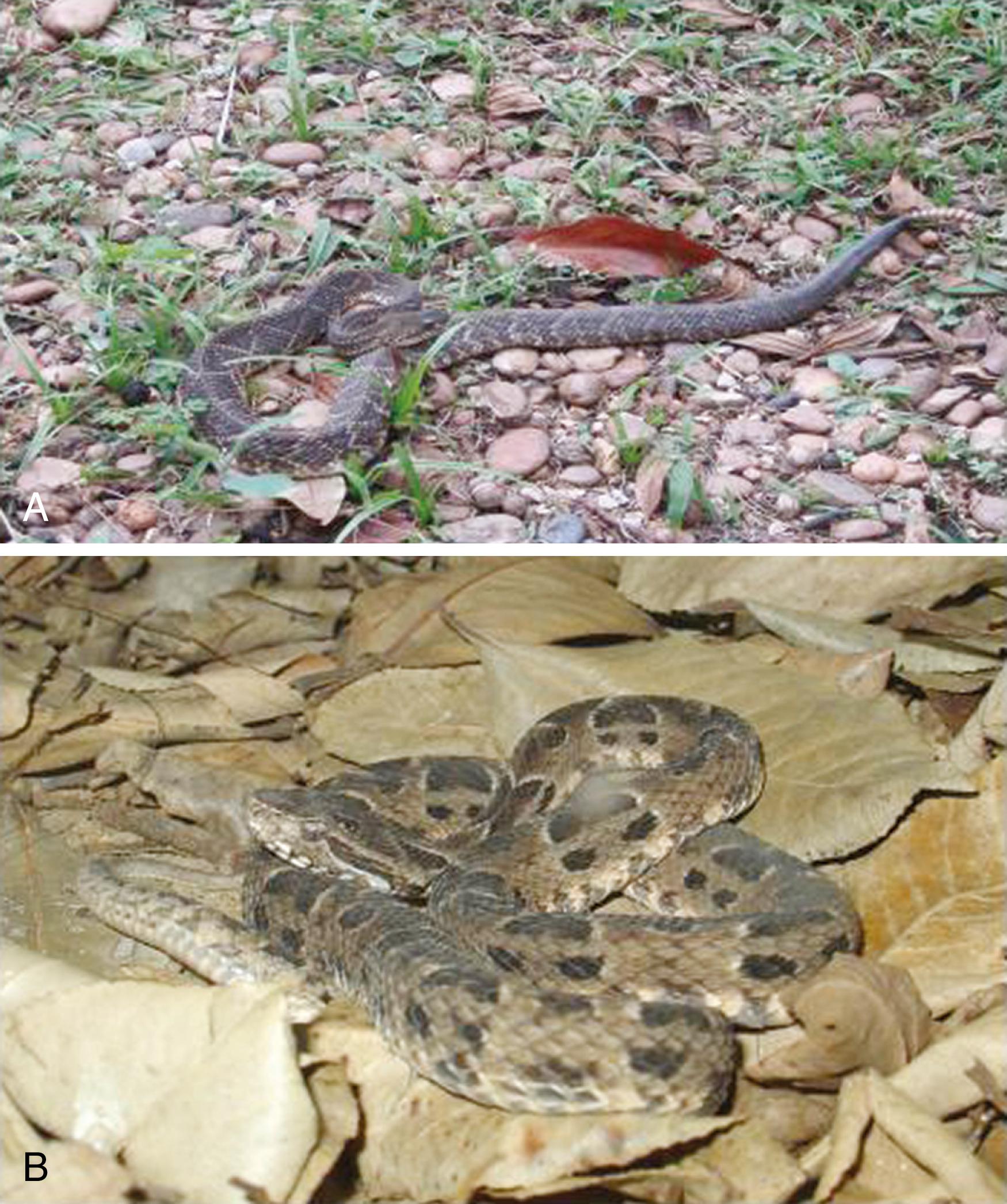 Fig. 52.3, A, Crotalus durissus, the South American rattlesnake of the Viperidae family. The venom is mainly neurotoxic, but it can cause skin necrosis. B, The jararacas ( Bothrops genus) can provoke extremely severe necrosis of the skin and deep structures in humans, as observed in other snakes of the Viperidae family. This snake is a spotted jararaca (Bothrops matogrossensis) .