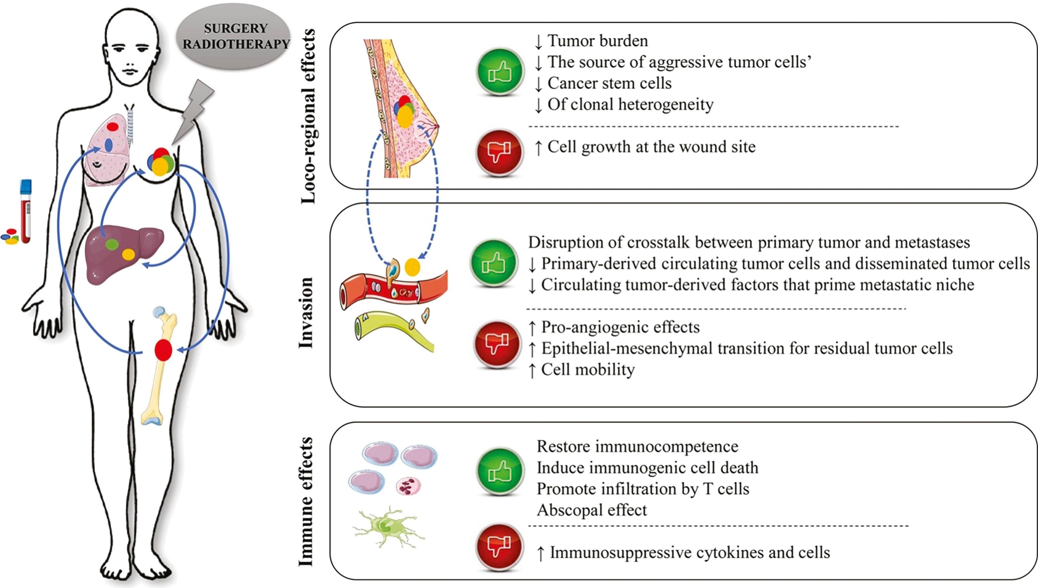Fig. 55.1, Postulated interactions between the primary tumor and metastatic sites.