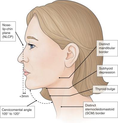 FIGURE 12.2, Ideal youthful neck lines, as described by Ellenbogen and Karlin. 1