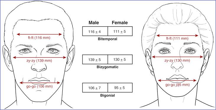Fig. 12.1, Normal values in millimeters for upper, middle, and lower facial width in white North American adult men (ages 19 to 25) ( n = 109) and young white adult women ( n = 200). 1 The bigonial distance (go–go) is measured from gonion (go) to gonion, which is the most lateral point of the mandibular angle close to the bony gonion. Note that the male lower face is both relatively and absolutely wider than that of the female.