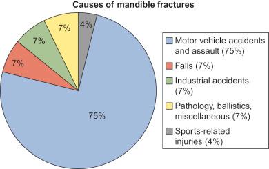 Fig. 1.14.1, Causes of mandible fractures by percentage. 13 14