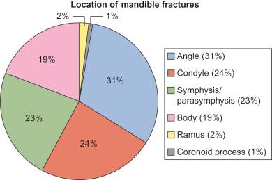 Fig. 1.14.2, Anatomic location of mandible fractures by percentage. 14 15