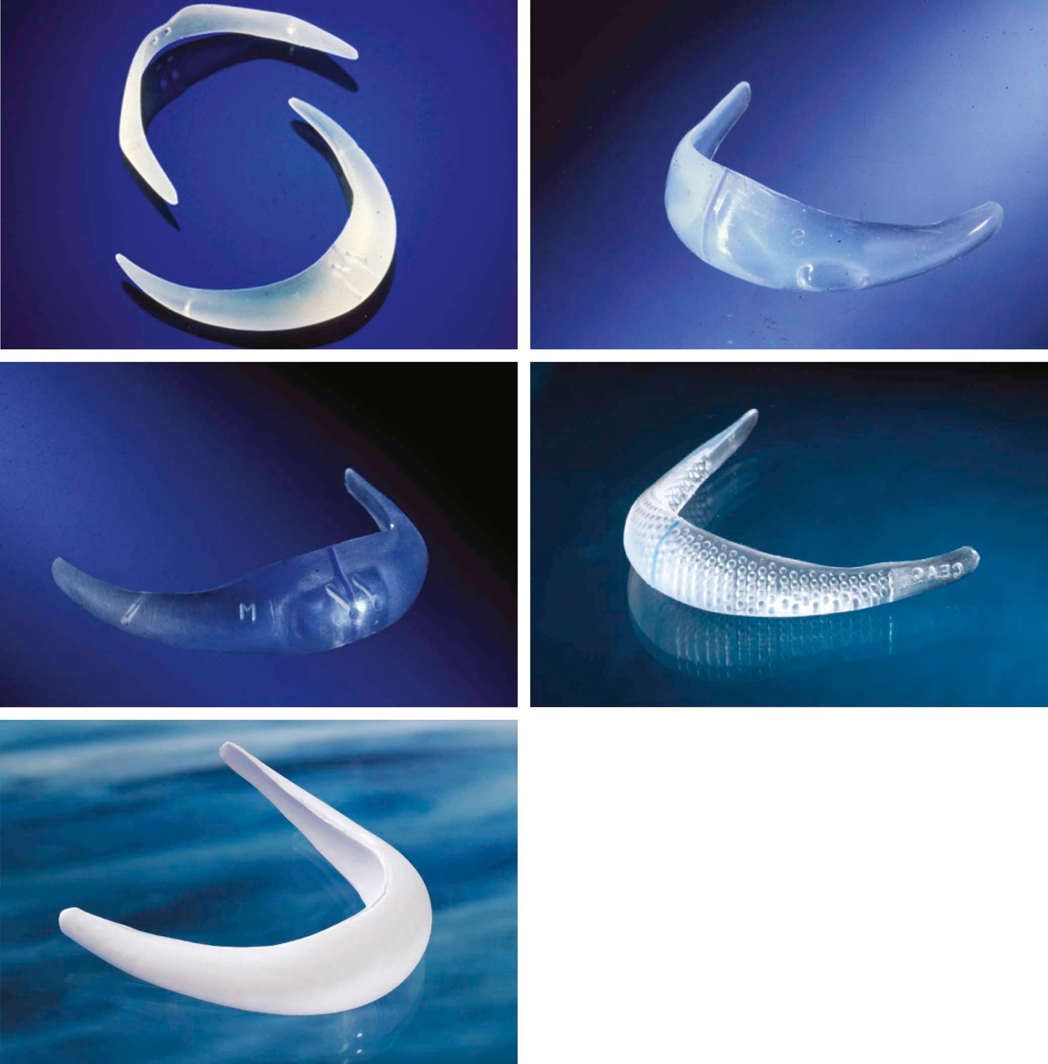 Figure 17-9, Newer shapes of implants have extended the number of indications for mentoplasty.