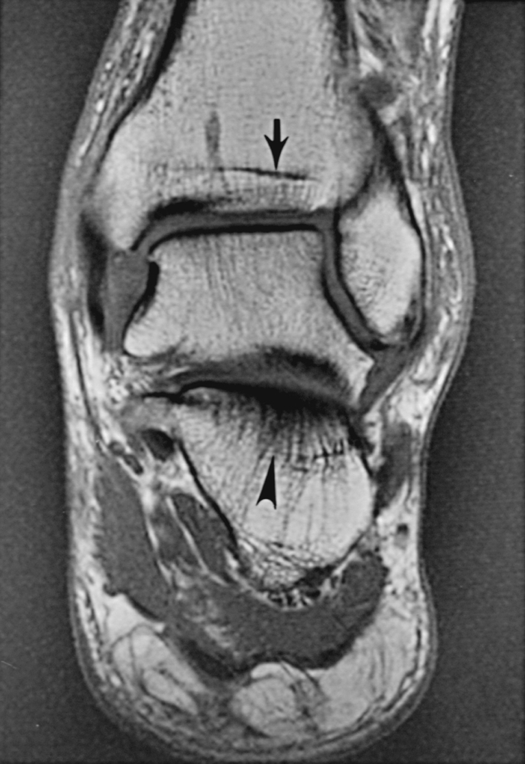 Fig. 2.5, Normal yellow marrow.