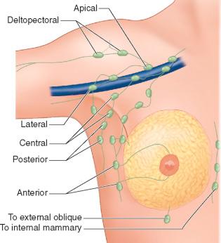F igure 48-3-2, The axilla is divided into three levels: I, II, III according to the location of lymph nodes, lateral, posterior, and medial relative to the pectoralis minor muscle.