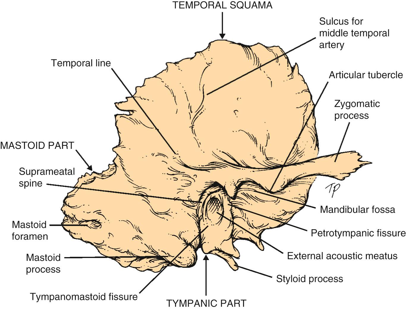 Fig. 143.1, Right temporal bone. Lateral view.