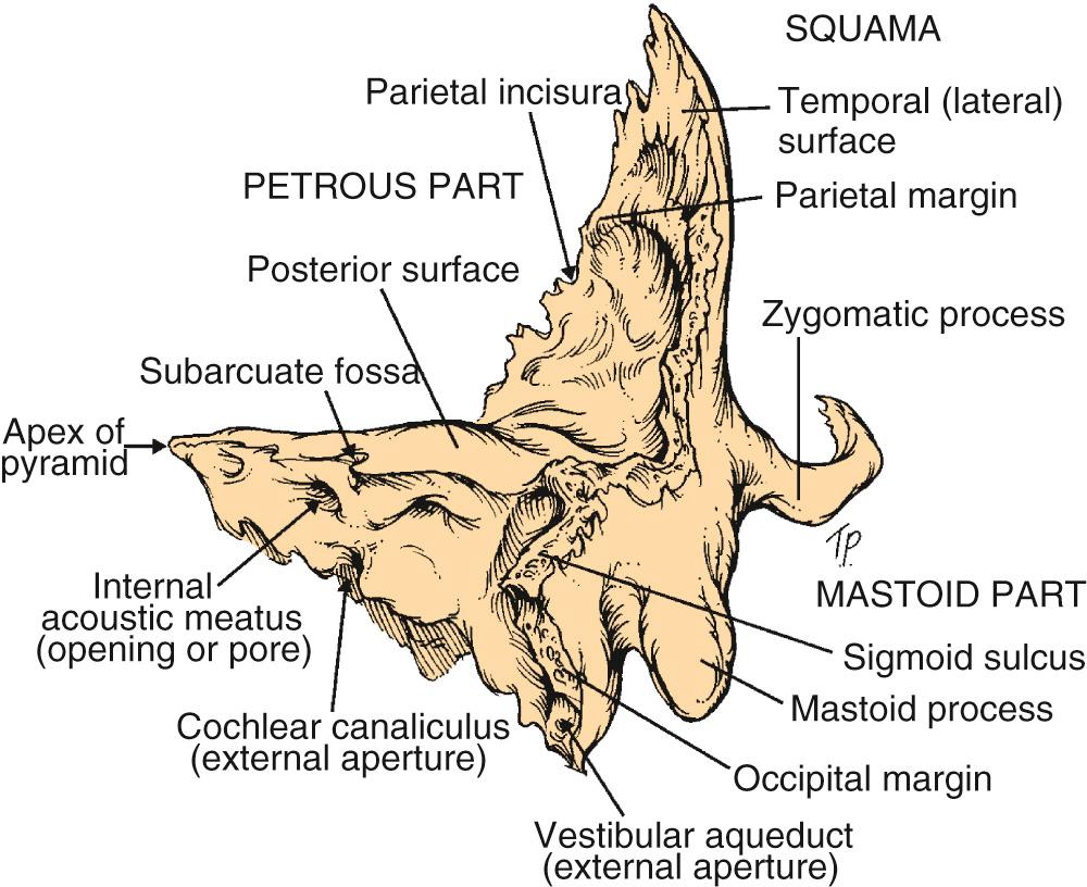Fig. 143.2, Left temporal bone. Posterolateral view.