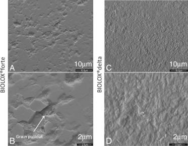 Fig. 6.3, Scanning electron micrographs of surfaces of retrieved ceramic THA femoral heads showing clear, faceted sides typical of grain pullout. (A) and (B) show the worn surface of a BIOLOX forte alumina ceramic head, while (C) and (D) show the worn surface of a BIOLOX delta zirconia-toughened alumina head. The grain size for BIOLOX forte material is larger, leading to larger defects on the surface when grain pullout occurs.