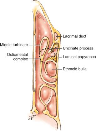 Fig. 6.3, Drawing in axial view showing the relationship between the uncinate process, ethmoid bulla, and middle turbinate. Dashed circle represents the ostiomeatal complex.