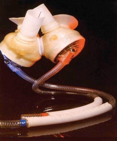 Figure 22-17, SynCardia total artificial heart.