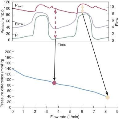 Figure 22-3, Relationship between pump flow and pressure differences across inlet and outlet orifices of HeartMate II pump during cardiac cycle. Key: Paort, Aortic pressure; P L , left ventricular pressure.