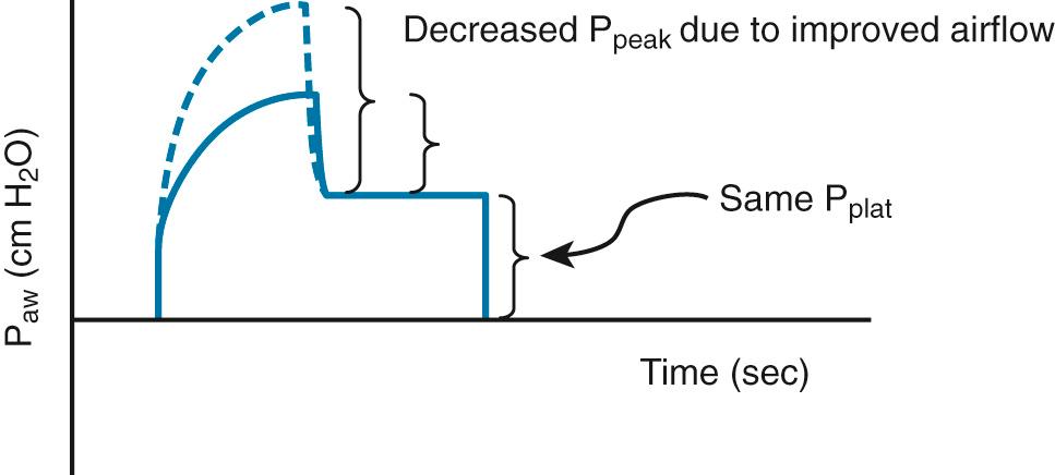 Figure 8.2, Schematic of two superimposed pressure-time curves showing an isolated decrease in peak inspiratory pressure (P peak ) with no change in plateau pressure (P plat ) as airflow resistance improves. P aw , Airway pressure.