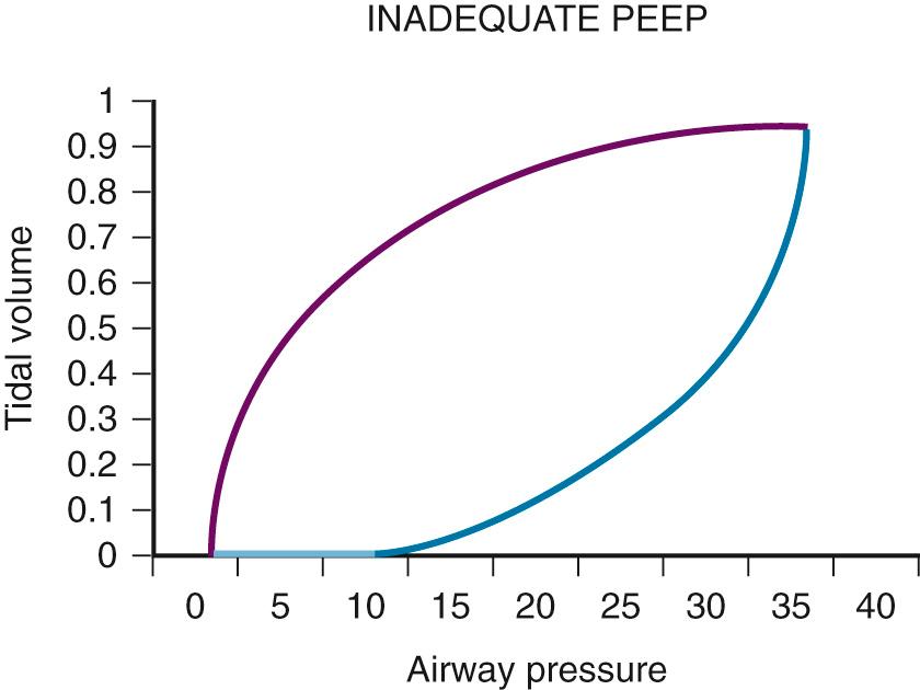 Figure 8.5, Inadequate positive end-expiratory pressure (PEEP) and the pressure-volume loop. Compare this curve with that in Fig. 8.4 . Note that the loop is initially flat (lower segment) along the x-axis. Once airway pressure is high enough to open the alveolar units, each increase in airway pressure is matched by a corresponding increase in tidal volume.