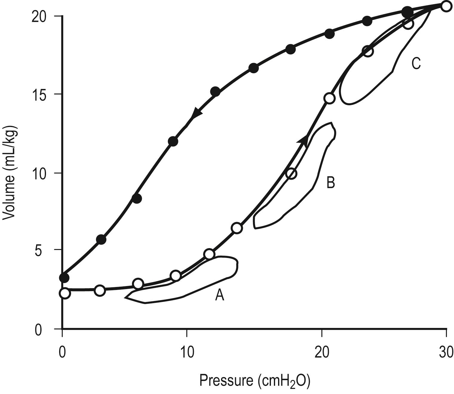 Fig. 7.3, Static lung compliance curve in a normal lung. Effective compliance would be altered depending on whether functional residual capacity (FRC) were to be at a level resulting in lung atelectasis (point A) or overdistention (point C). Optimal lung mechanics are observed when FRC is set on the steepest portion of the curve (point B).