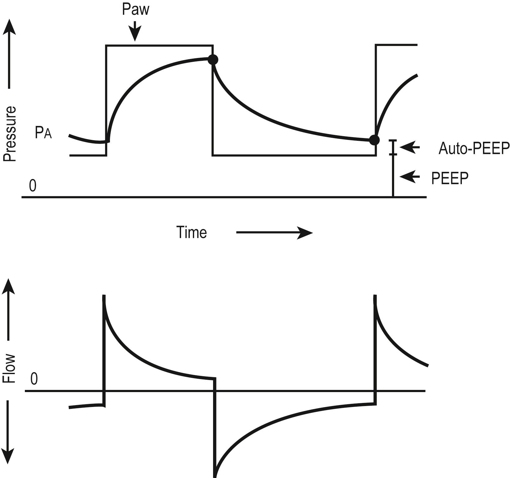 Fig. 7.7, Pressure and flow waveforms during pressure-limited, time-cycled ventilation. Decelerating flow is applied, which “front loads” the pressure during inspiration. Auto-positive end-expiratory pressure is present when the expiratory time is inadequate for complete expiration.